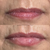 Lip Plumper