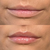 Lip Plumper - Opretty